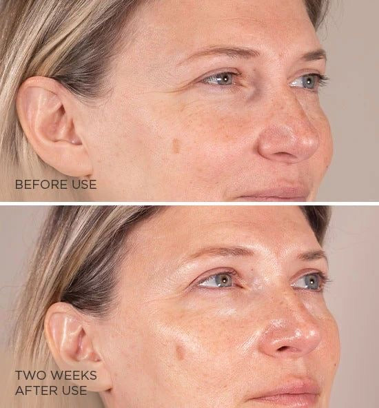 Derma Roller pour la croissance des cheveux et de la peau