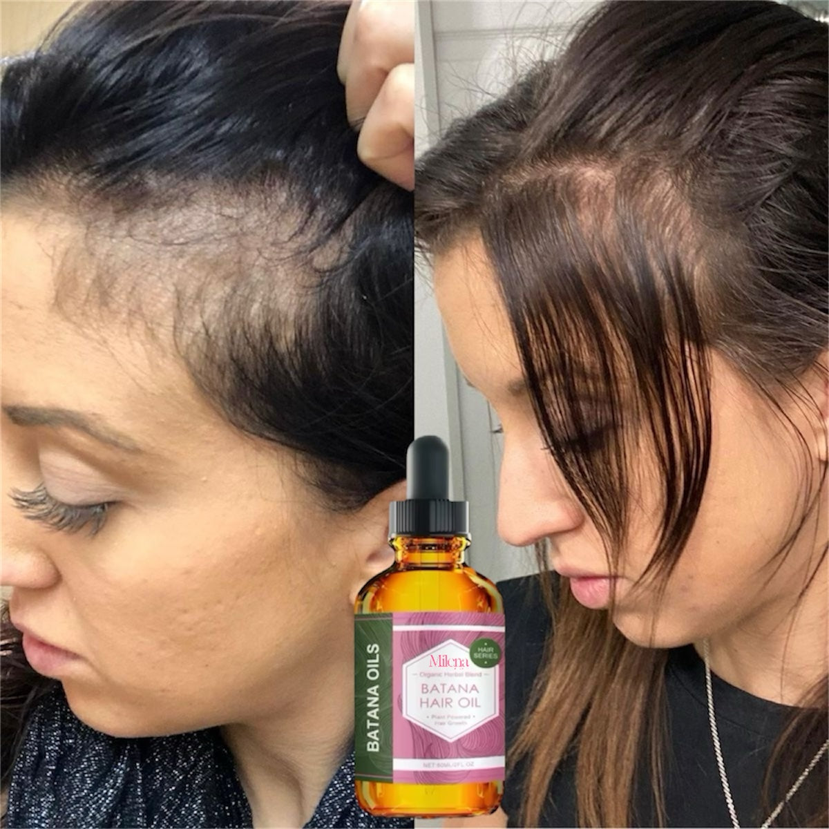 Batana Oil for Hair growth & Anti hair Loss