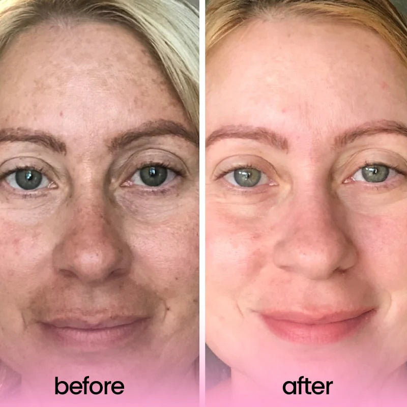 Coton au Curcuma et à l'Acide Kojique : Visage & Corps - 40 pièces