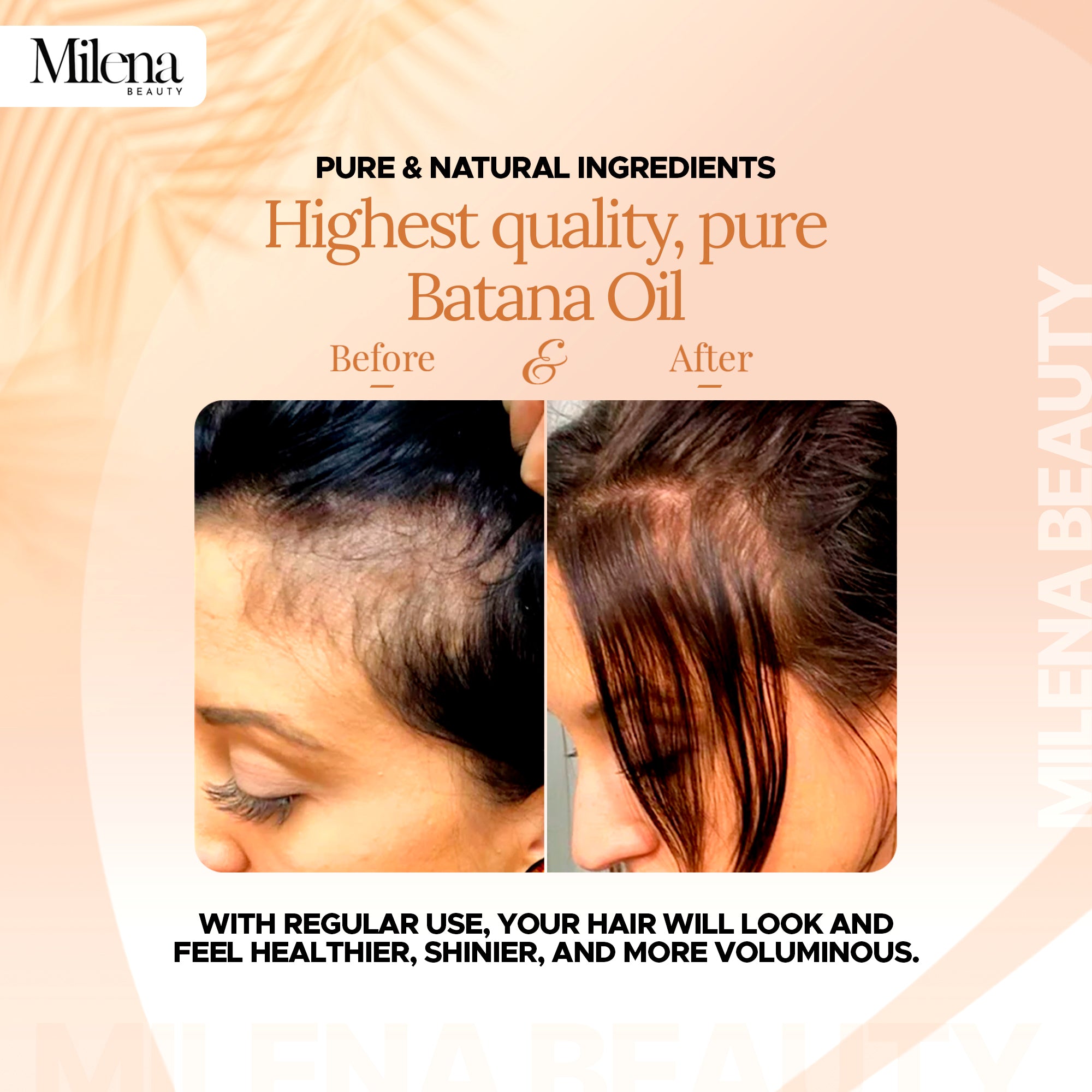Batana Oil for Hair growth & Anti hair Loss