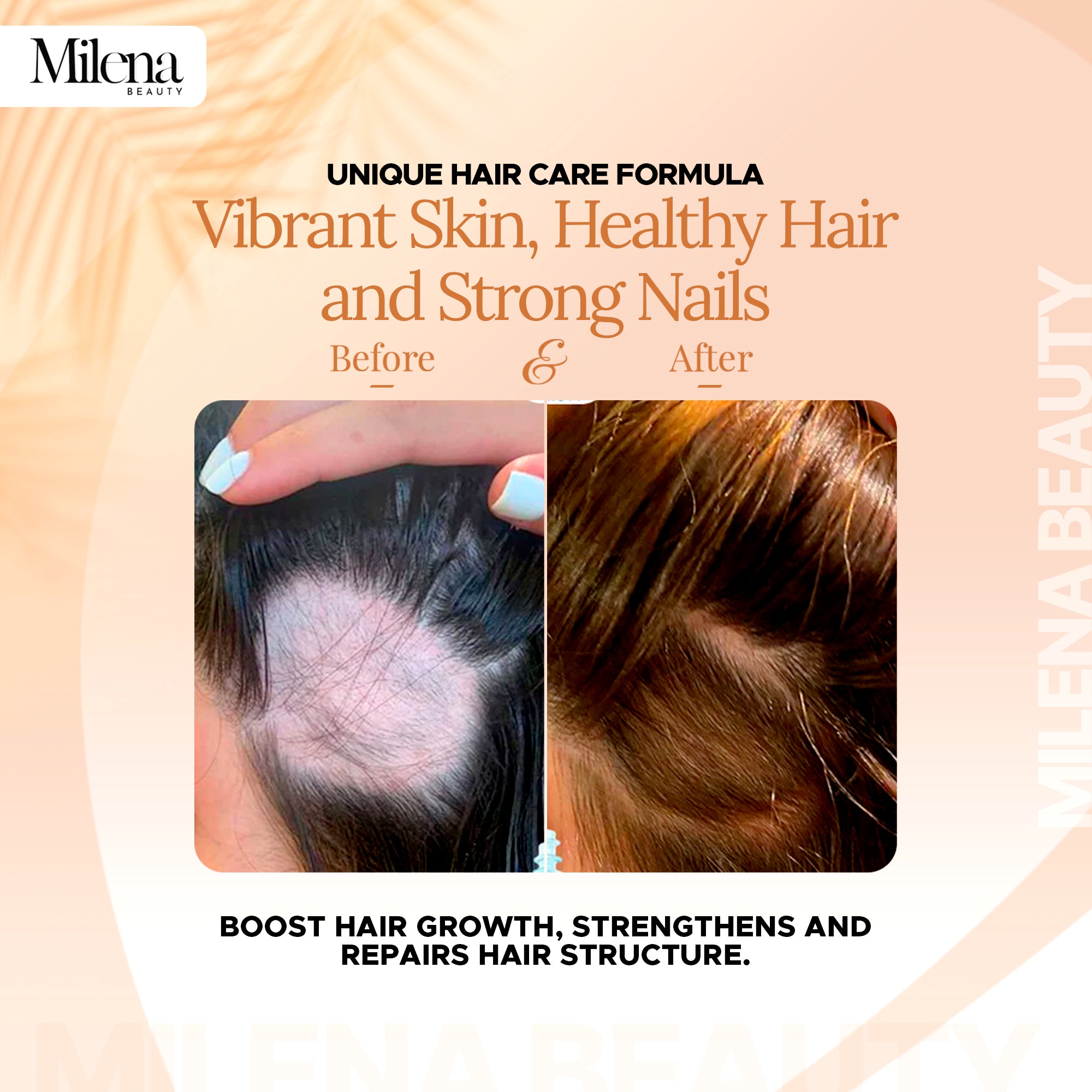 Milena Gummies ~ Collagen Biotin keratin