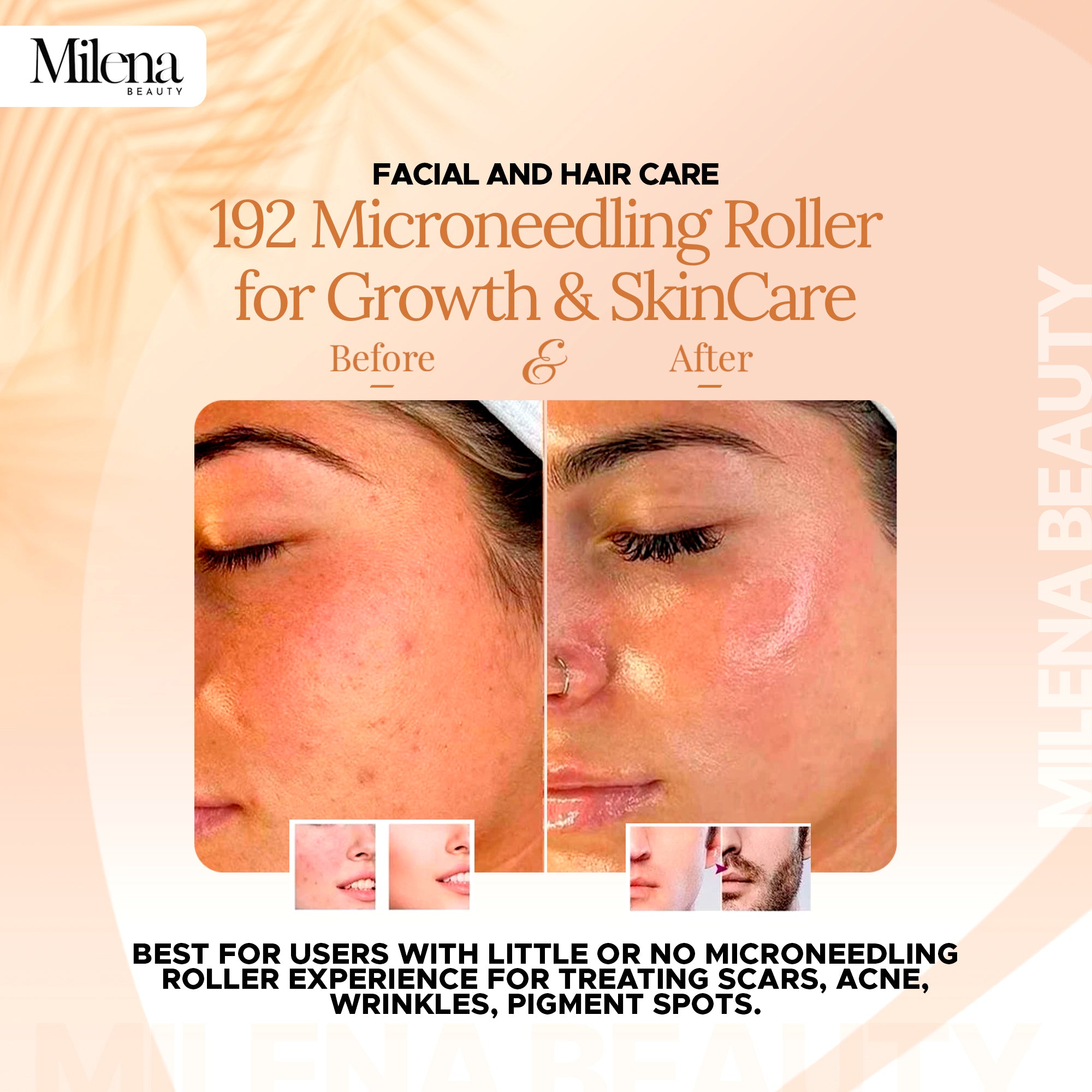 Derma Roller pour la croissance des cheveux et de la peau