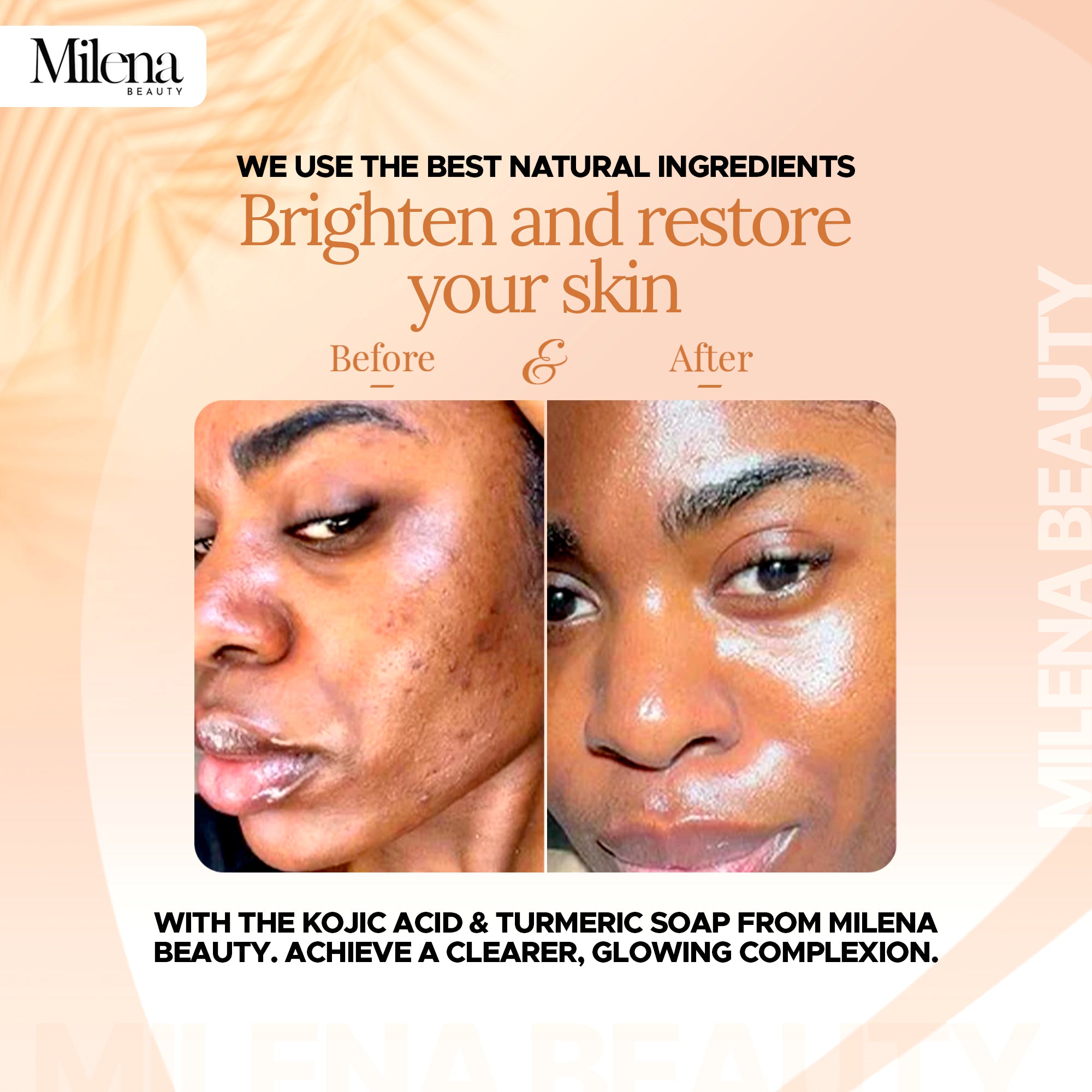 Turmeric Kojic Acid Soap - Imperfection / Hyperpigmentation