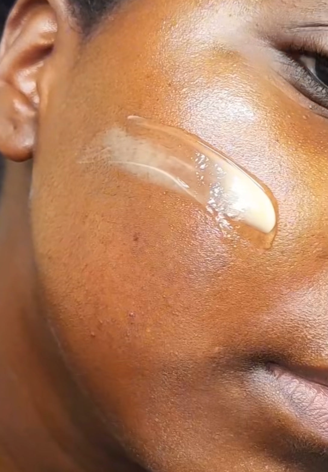 Niacinamide and Vitamin C: A Powerhouse Duo for Your Skin